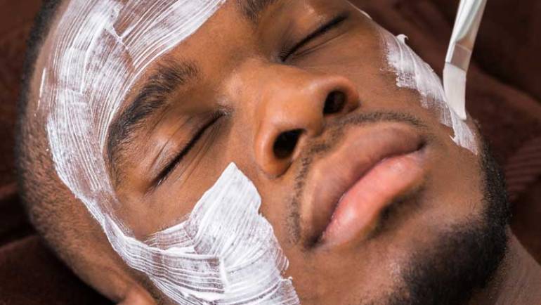 chemical peel