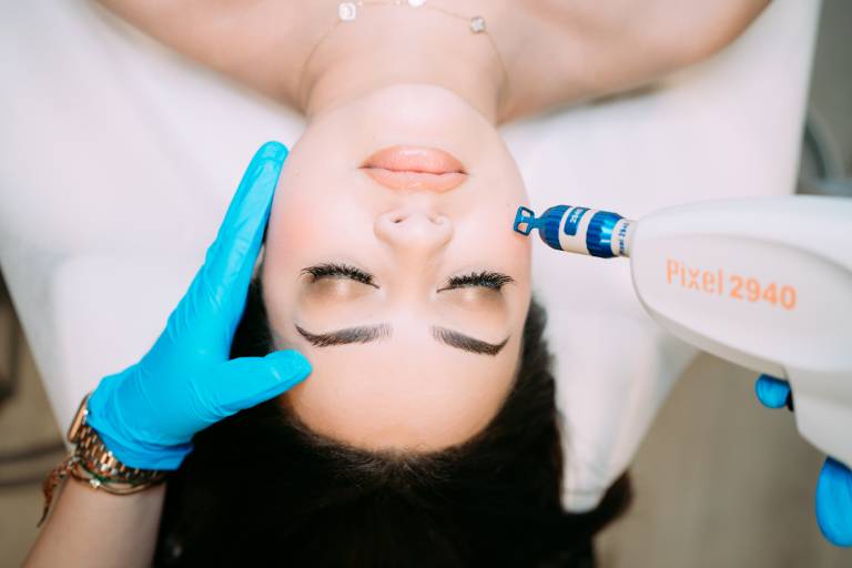 Pixel Laser Skin Resurfacing Northern Virginia