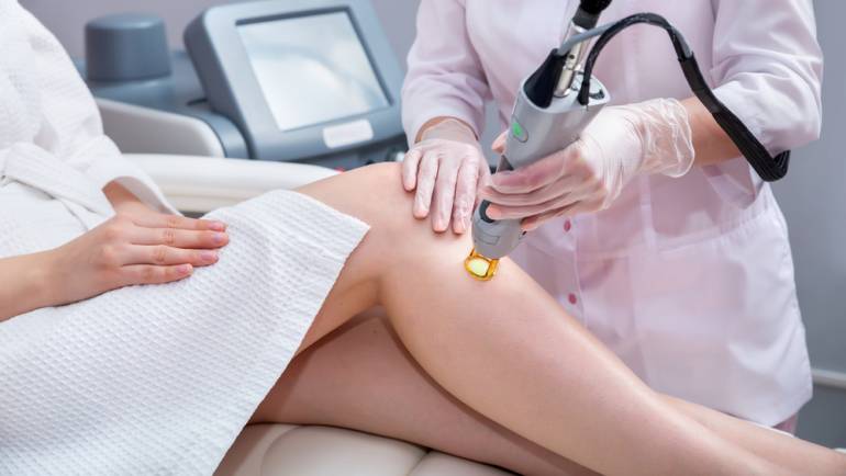 Laser Hair Removal in Northern Virginia