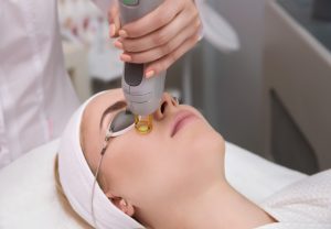 Laser Skin Tightening