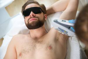 Best Laser Hair Removal for Men in Virginia