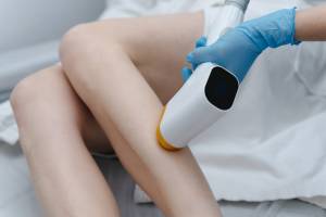 Best Laser Hair Removal for All Skin Types in Chantilly