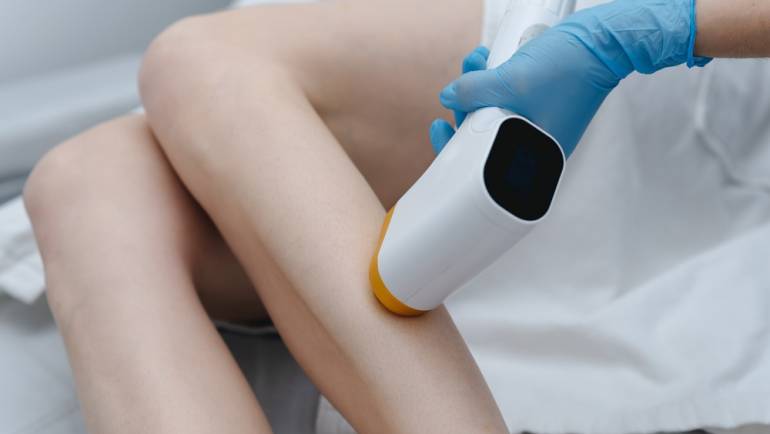 Best Laser Hair Removal for All Skin Types in Chantilly
