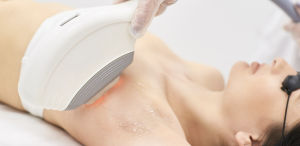 Laser Hair Removal Cost Near Annandale