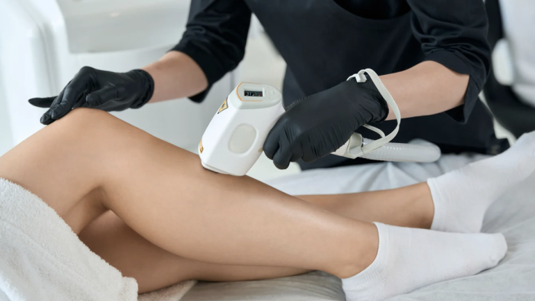 Best Age to Get Laser Hair Removal