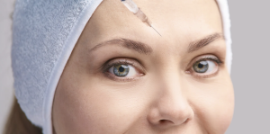 Top-Rated Botox Clinic in Fairfax