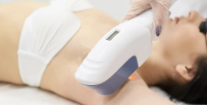 Laser Hair Removal FAQs