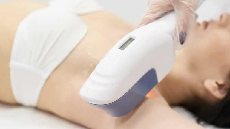 Laser Hair Removal FAQs