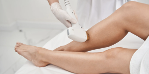 Long-Lasting Laser Hair Removal Results