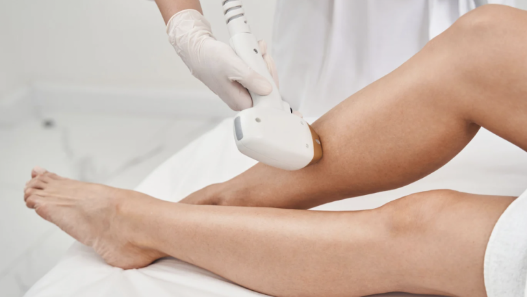 Long-Lasting Laser Hair Removal Results