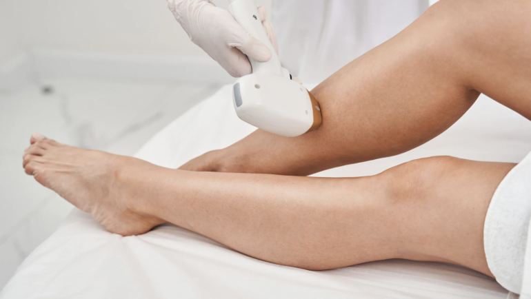 Laser Hair Removal Session in Alexandria