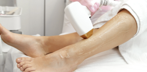 Laser Hair Removal Appointment Near Fairfax