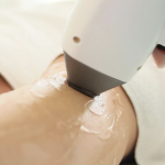 Laser Hair Removal Pricing in Sterling Virginia