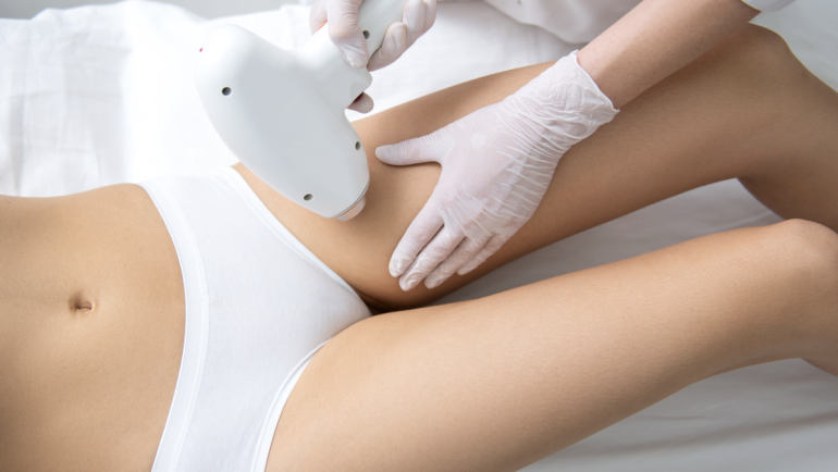 Brazilian Laser Hair Removal Near Brambleton Virginia