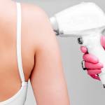 Teenage Laser Hair Removal in Virginia