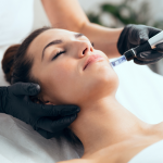 Microneedling Specials in Falls Church, Virginia