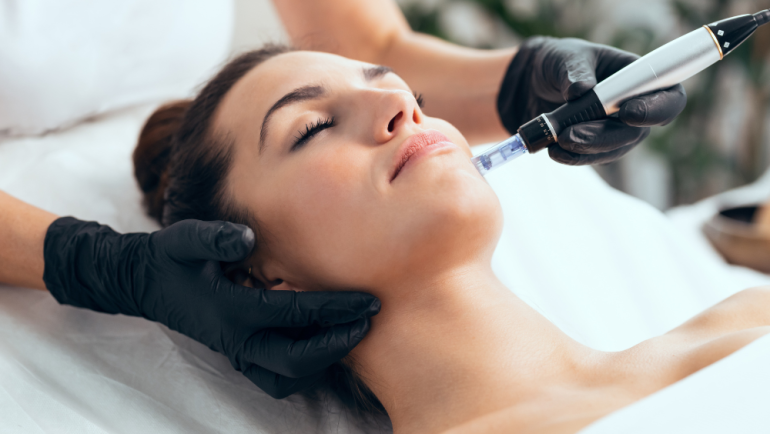 Microneedling Specials in Falls Church, Virginia