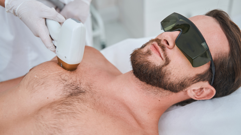 Laser Hair Removal Packages in Sterling, Virginia