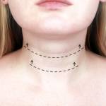 Affordable Neck Skin Tightening Services Near Burke, Virginia: 3 Treatments That Should Be on Your Radar