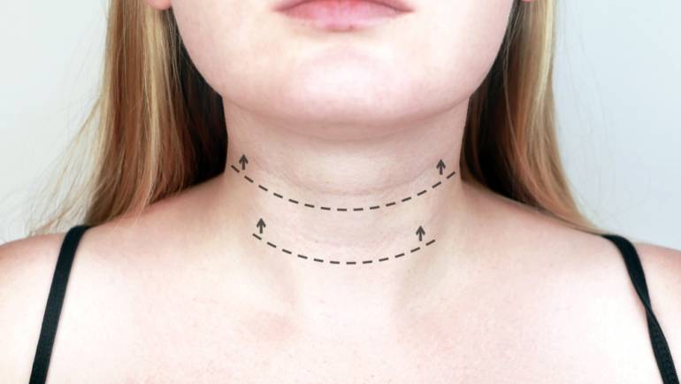 Affordable Neck Skin Tightening Services Near Burke, Virginia: 3 Treatments That Should Be on Your Radar