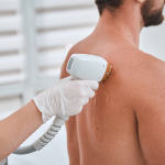 Low-Cost Laser Hair Removal in Purcellville, VA