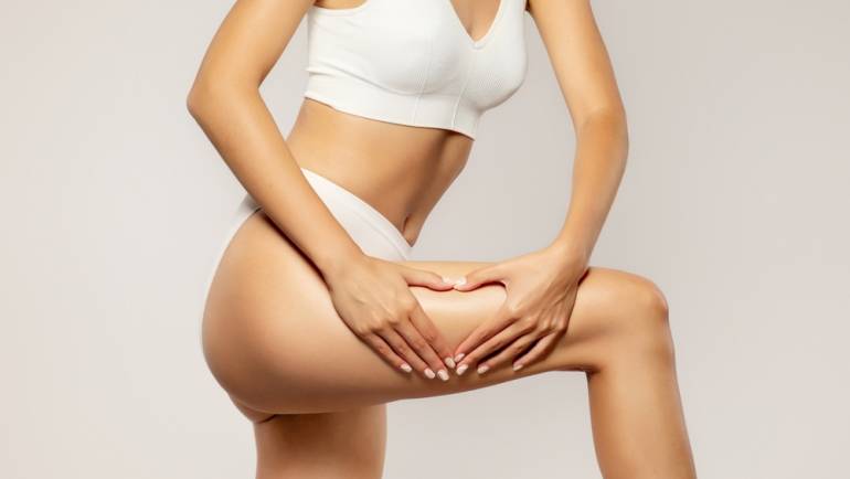 What Is the Best Treatment for Cellulite?