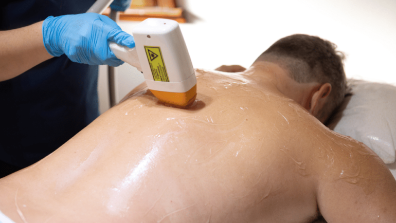 Why Loudoun Residents of Any Age Choose Lasers for Hair Removal