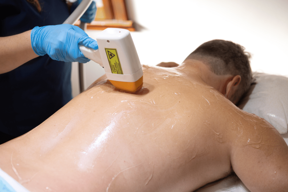 Why Loudoun Residents of Any Age Choose Lasers for Hair Removal