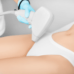 #1 Best Laser Hair Removal in Virginia